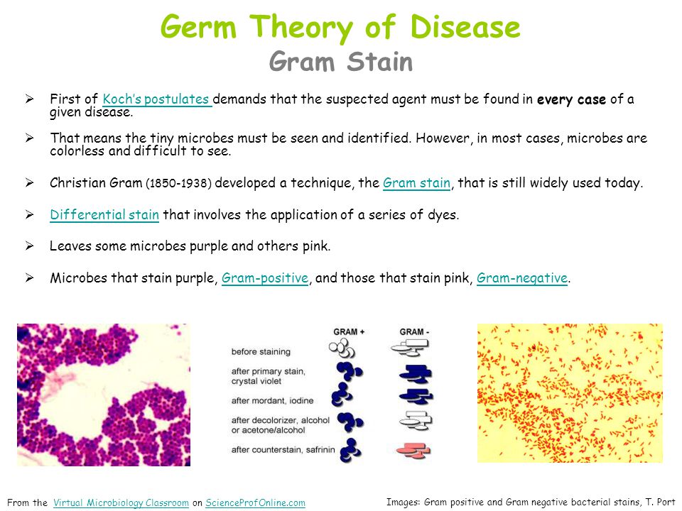 The history of germ theory